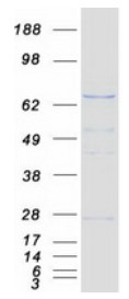 SDS-PAGE PRMT5-4447H.jpg